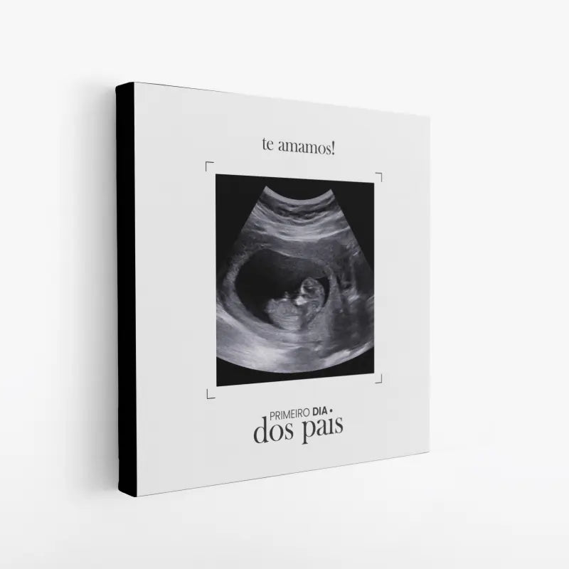Quadro-Personalizado-Quadrado-Ultrassom-03