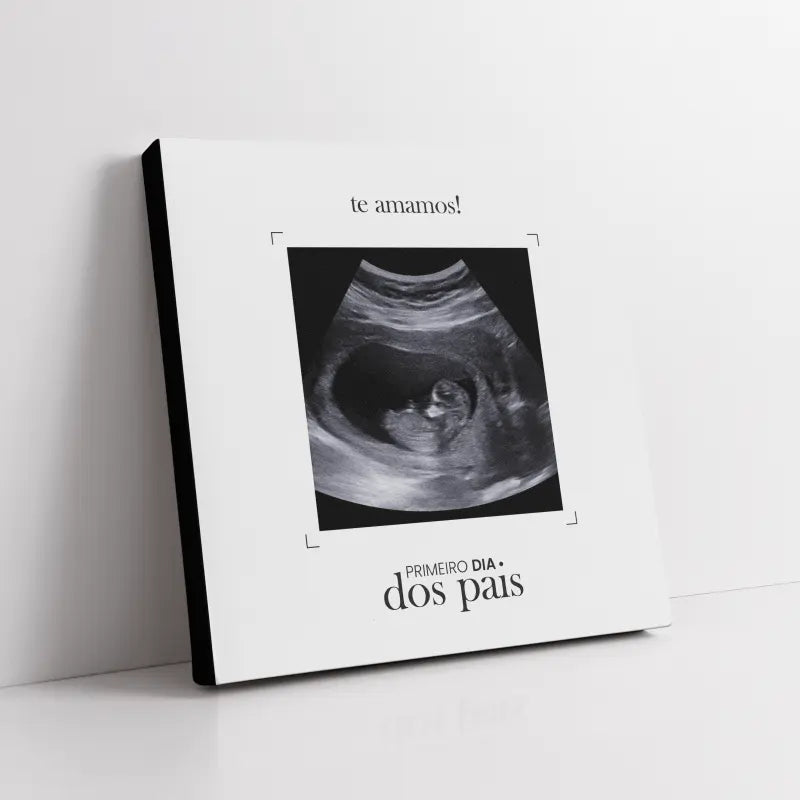Quadro-Personalizado-Quadrado-Ultrassom-04